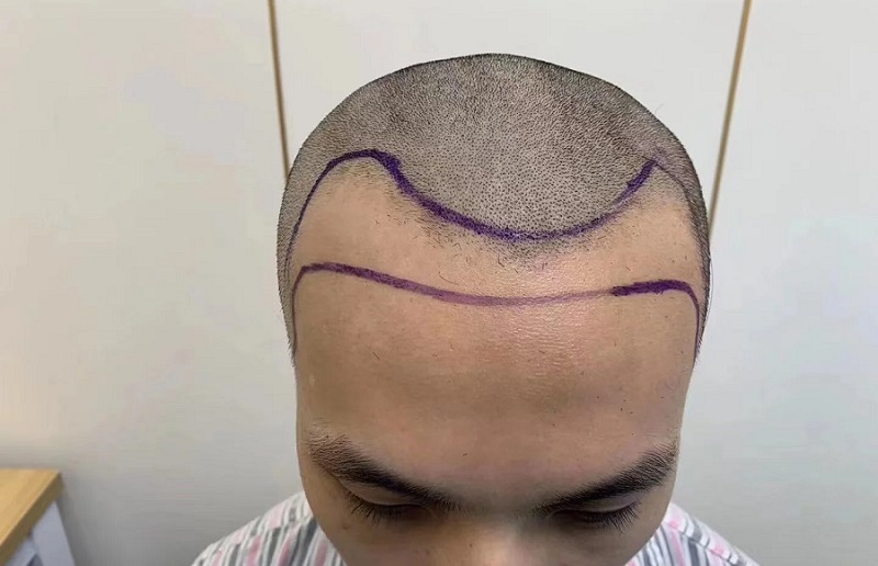 й޽ֲҽԺа ޽ֲҽԺǰ50