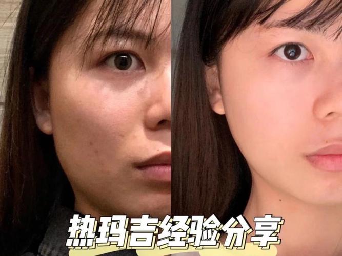 2025年晋城市做肚子吸脂手术整形医院排名榜根据自己的预算来选择哦 2025年晋城市做肚子吸脂手术整形医院排名榜根据自己的预算来选择哦