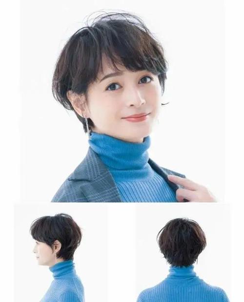 廊坊市上睑提肌肌腱折叠上睑下垂矫正术医院上榜名单 廊坊零皙医疗美容诊所老牌医美口碑出众 廊坊市上睑提肌肌腱折叠上睑下垂矫正术医院上榜名单 廊坊零皙医疗美容诊所老牌医美口碑出众