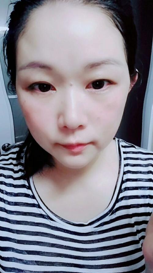 潮州市全瓷贴面收费标准参考公开 潮州市全瓷贴面价格 潮州市全瓷贴面收费标准参考公开 潮州市全瓷贴面价格