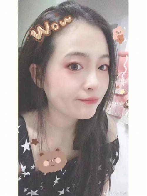 张家港市鼻小柱疤痕修复医生上榜名单实力挨个分析 欧阳武医生去的人多且价格优惠 张家港市鼻小柱疤痕修复医生上榜名单实力挨个分析 欧阳武医生去的人多且价格优惠