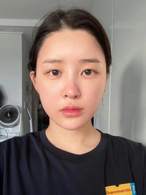 曲靖市贴面牙齿医生排行榜前十佳实力公开 曲靖市庞富升口腔医生 曲靖市贴面牙齿医生排行榜前十佳实力公开 曲靖市庞富升口腔医生