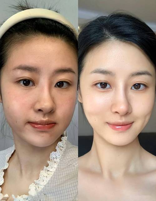 2025年锦州市牙根暴露治疗医院排行榜前三私立预约方便 锦州市牙根暴露治疗口腔医院 2025年锦州市牙根暴露治疗医院排行榜前三私立预约方便 锦州市牙根暴露治疗口腔医院