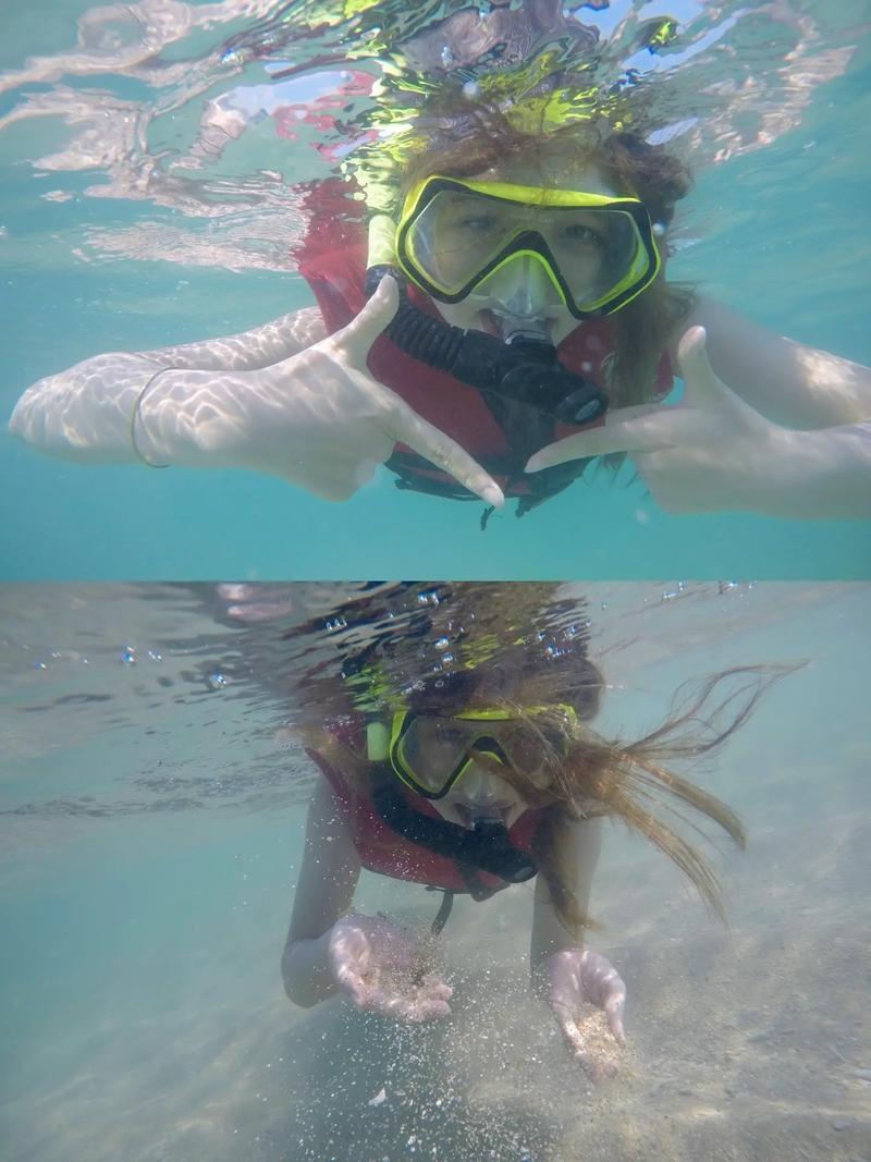 抚顺市激光祛斑皮秒价格价位表怎么样全新 抚顺市激光祛斑皮秒价格到底是多高 抚顺市激光祛斑皮秒价格价位表怎么样全新 抚顺市激光祛斑皮秒价格到底是多高