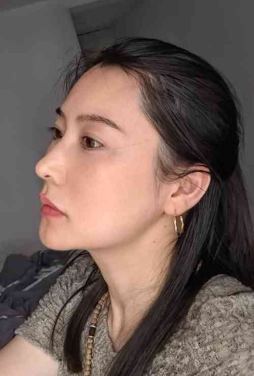 北京市小耳再造整形术医院排行前三前九名单 北京小芙(原善诚卉)医疗美容门诊部上榜机构各个实力不俗 北京市小耳再造整形术医院排行前三前九名单 北京小芙(原善诚卉)医疗美容门诊部上榜机构各个实力不俗