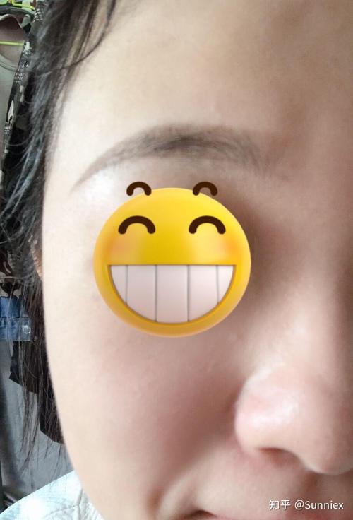 天水市面部注射物取出整形医生上榜名单top10权威详解 陈继红医生都是高人气医生 天水市面部注射物取出整形医生上榜名单top10权威详解 陈继红医生都是高人气医生