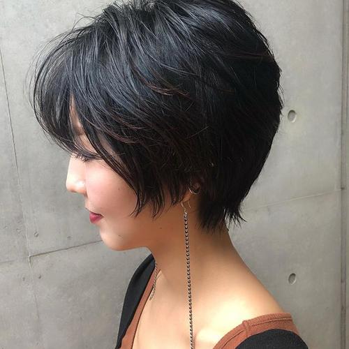 ʯׯ˫ƤҽԺļ۸(ʯׯŷҽﲿȿ)