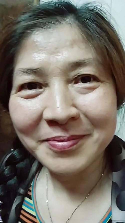 甘肃省产妊娠纹激光去除哪个医院最好呢(兰州美示医疗美容整形含新价格表收费标准) 甘肃省产妊娠纹激光去除哪个医院最好呢(兰州美示医疗美容整形含新价格表收费标准)