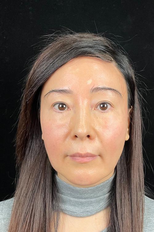 2025年保山市口腔脉冲激光治疗价格收费表全新版大公开 保山市口腔脉冲激光治疗术大概价格是多少 2025年保山市口腔脉冲激光治疗价格收费表全新版大公开 保山市口腔脉冲激光治疗术大概价格是多少