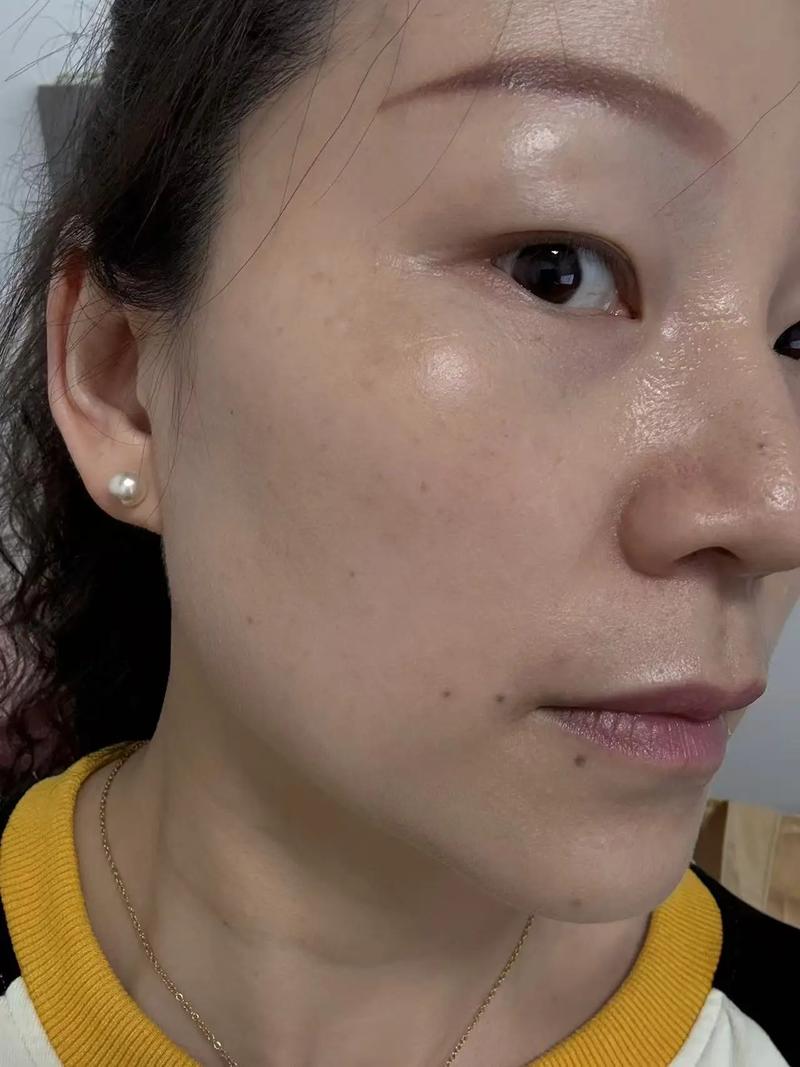 2025걱ֲܷҽԺڰؿ ֲܷǻҽԺ