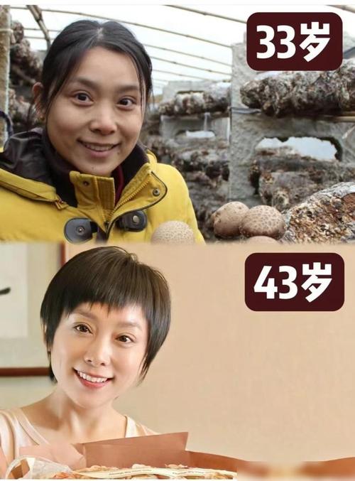 南阳市注射生长肽去皱医生排名榜前十评价上线 张娟医师医生价格挺靠谱 南阳市注射生长肽去皱医生排名榜前十评价上线 张娟医师医生价格挺靠谱