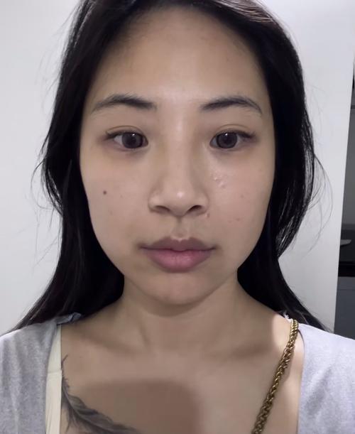 2025年开封市牙床畸形价格表修订版公开(开封市牙床畸形费用一共是多少) 2025年开封市牙床畸形价格表修订版公开(开封市牙床畸形费用一共是多少)