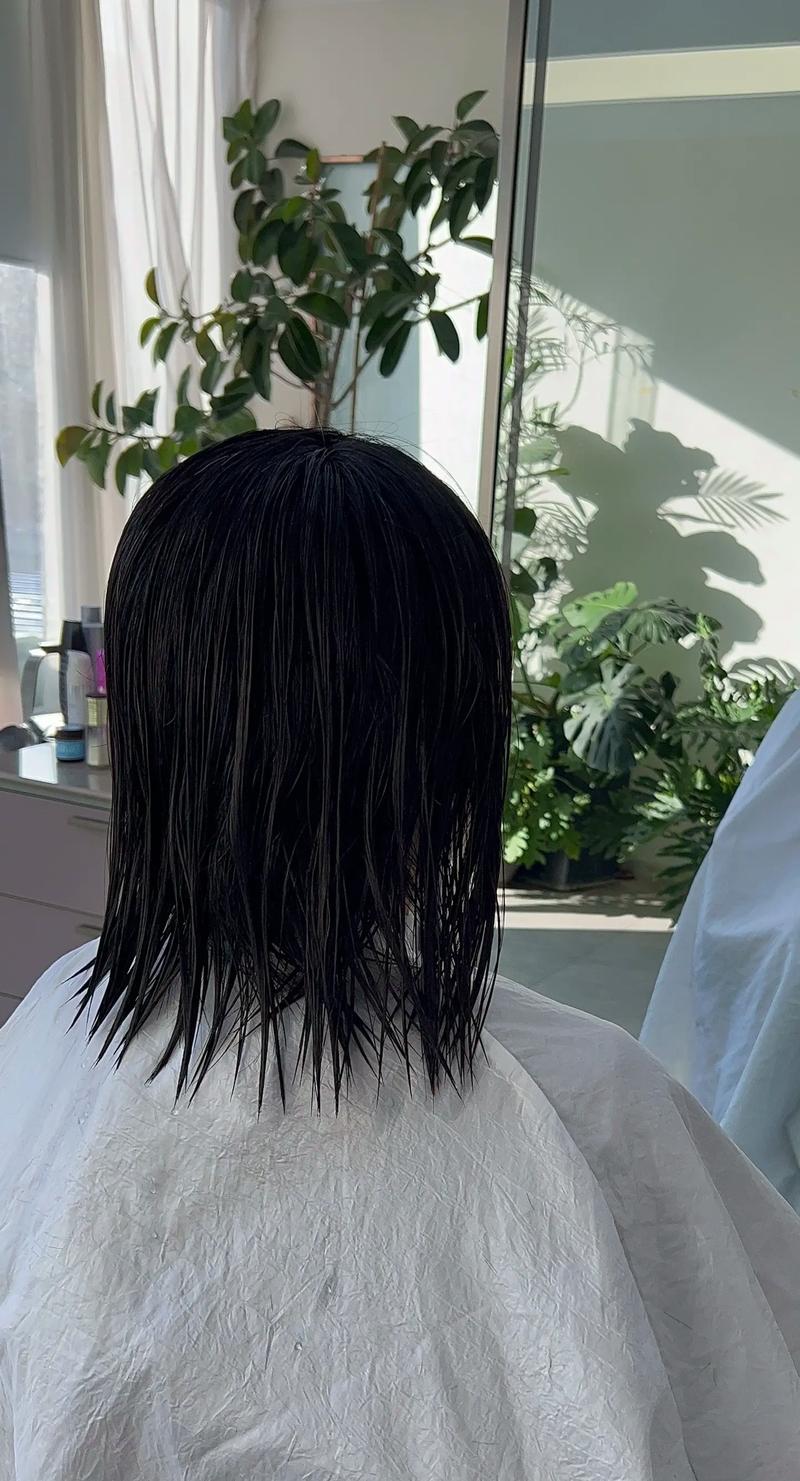 保定市鼻子向左歪矫正整形医院(保定悦美医疗美容技术特别靠谱) 保定市鼻子向左歪矫正整形医院(保定悦美医疗美容技术特别靠谱)