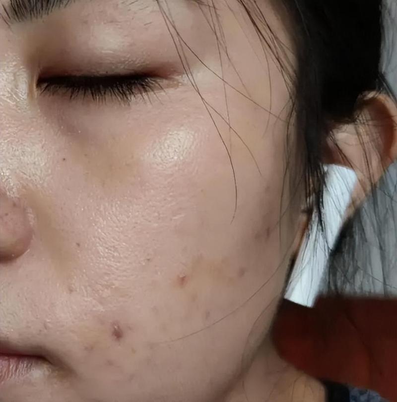 济南市拔上牙智齿医生在榜清单前十位年终发布 济南市赵明哲口腔医生 济南市拔上牙智齿医生在榜清单前十位年终发布 济南市赵明哲口腔医生