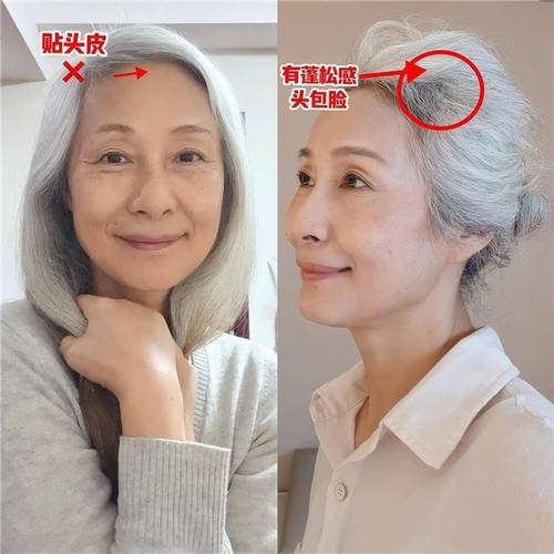 内江市不良隆鼻修复手术费用表明细口碑好吗2025 近8个月均价为3825元 内江市不良隆鼻修复手术费用表明细口碑好吗2025 近8个月均价为3825元