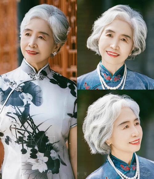 �Ӱ��г�Ƥ���޸���������ҽԺ(�Ӱ�ŷ����ҽ���������ﲿ���μ۸��ѯ)