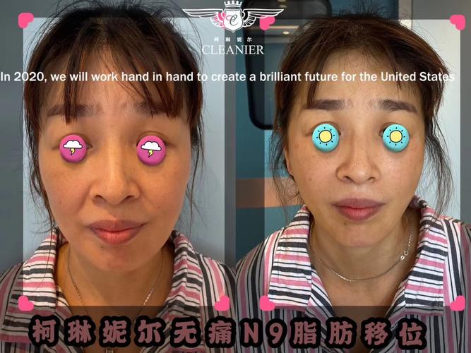 ��Ǩ���沿�ߵ����������ҽԺ ��Ǩ�����������������ﲿʵ���б���