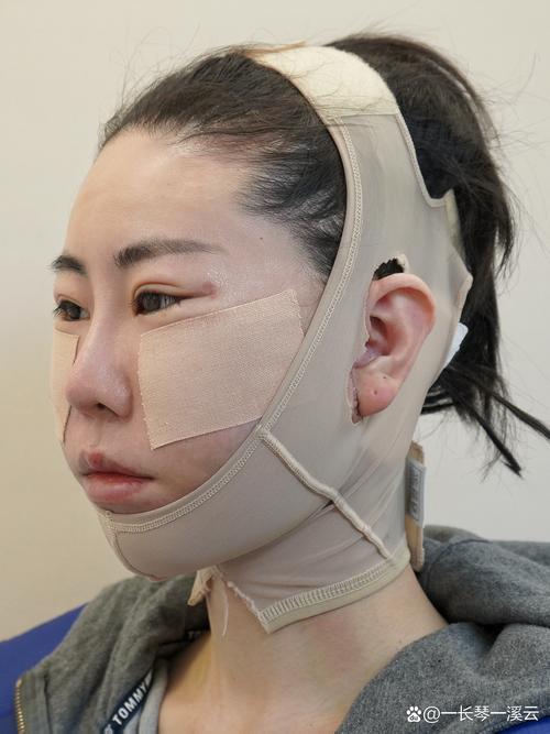 �������������ڽ��������в۽���ҽ���ڰ������ڱ���ɫ ������������ǻҽ��